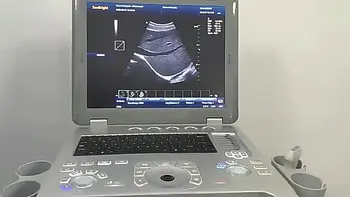 Портативный 15-дюймовый 2d 3d 4d Ч/Б и цветной доплеровский ультразвуковой сканирующий аппарат медицинские ультразвуковые инструменты для беременных Изображение